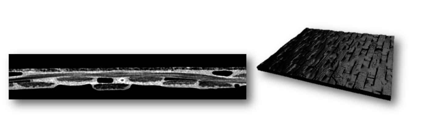 carbon-x-ray
